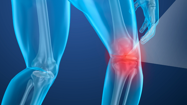 Stem-Cells-for-the-Treatment-of-Knee-Osteoarthritis