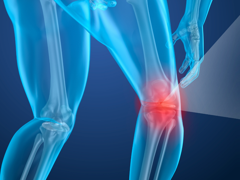 Stem Cells for the Treatment of Knee Osteoarthritis