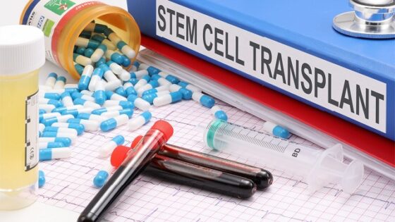 stem cell treatment process